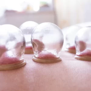 Italiano Masszázs - Budapest Városmajor - Kellemes masszázs köpölyözés